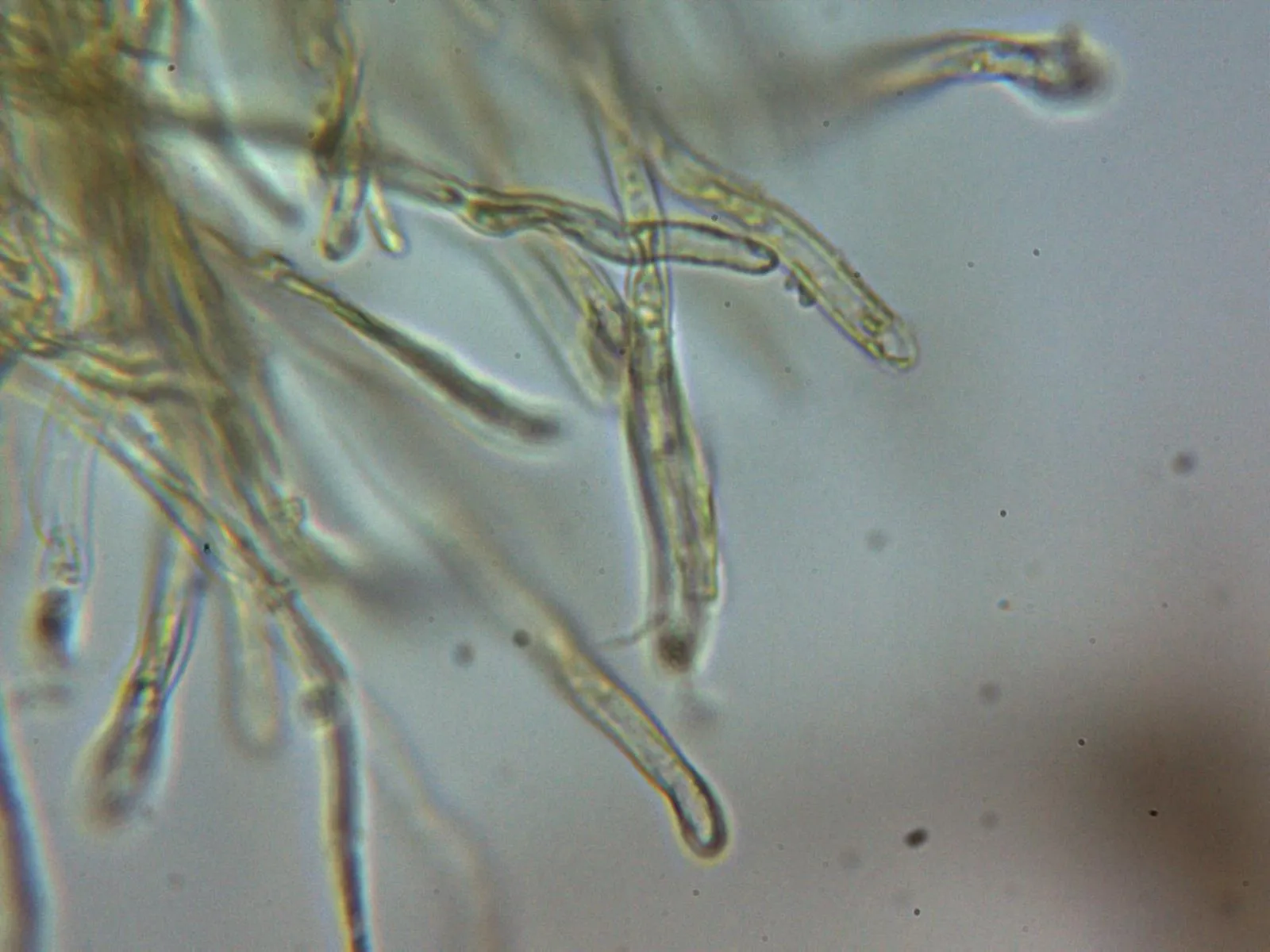 Microscopía de Trametes versicolor - 10 - Hifas terminales Melzer